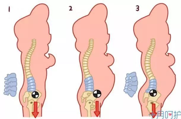 为什么坐月子容易得月子病,不坐月子有什么后果