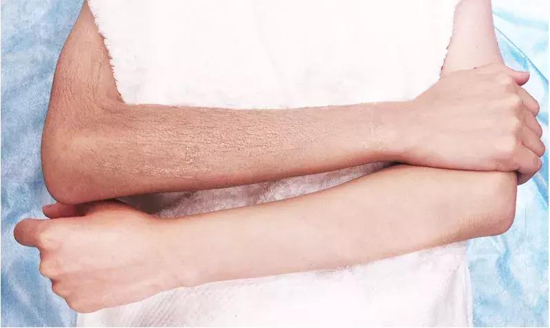 现在美容最火项目,激光脱毛品牌推荐美容院