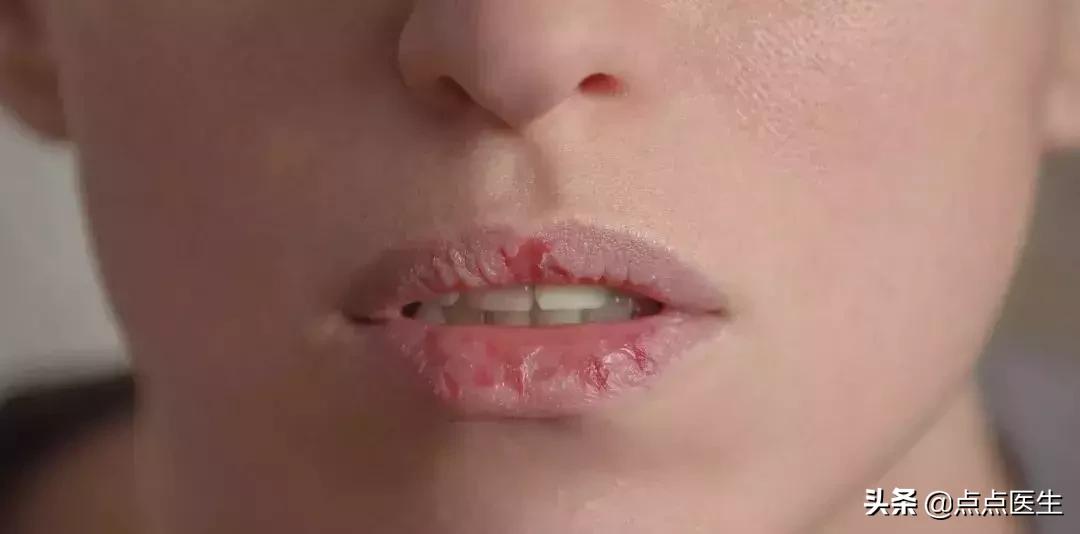 爱拔倒刺是心理疾病么,喜欢拔倒刺属于心理行为问题吗