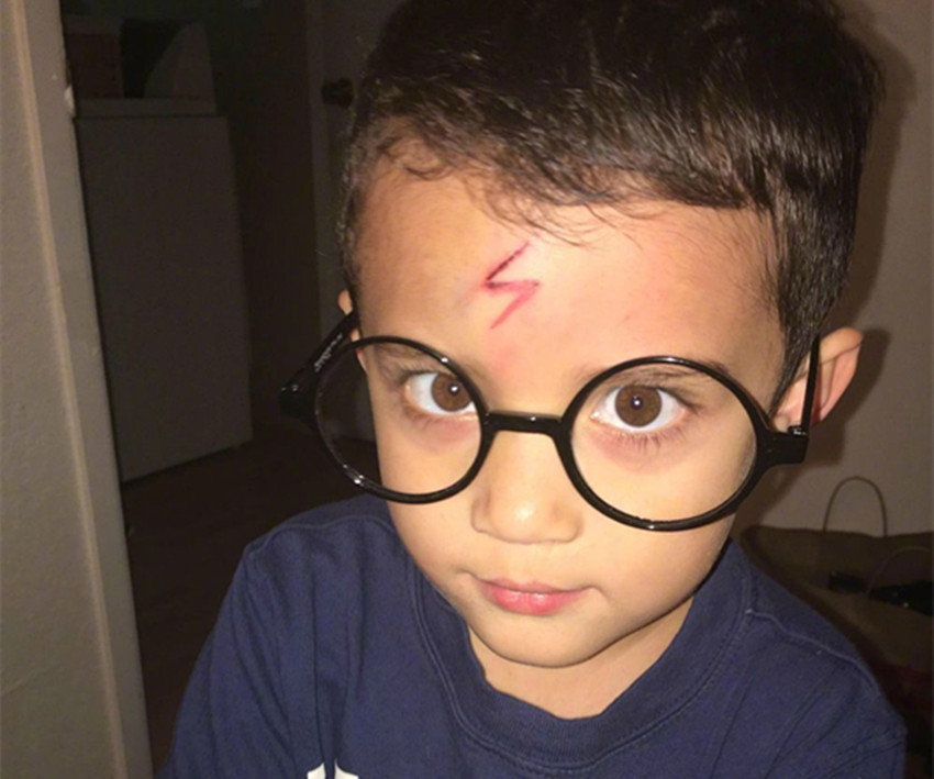 萌娃不小心撞到脑袋摔了一跤,萌娃不小心撞到脑袋摔一跤