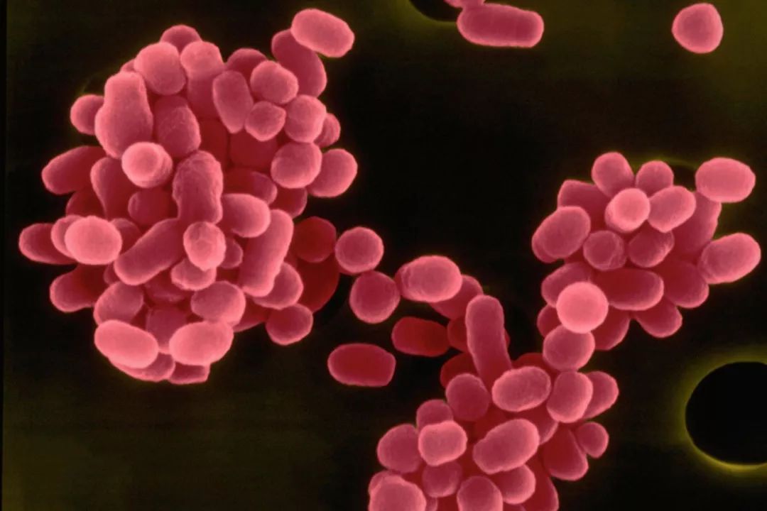 兰州兽医研究所学生布病感染回应,兰州布鲁氏菌病最新报告