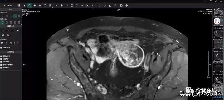 伦琴医疗项目,伦琴放射科