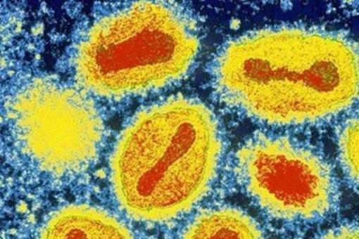 天花是人类唯一战胜的病毒,人类唯一消灭的病毒天花病毒