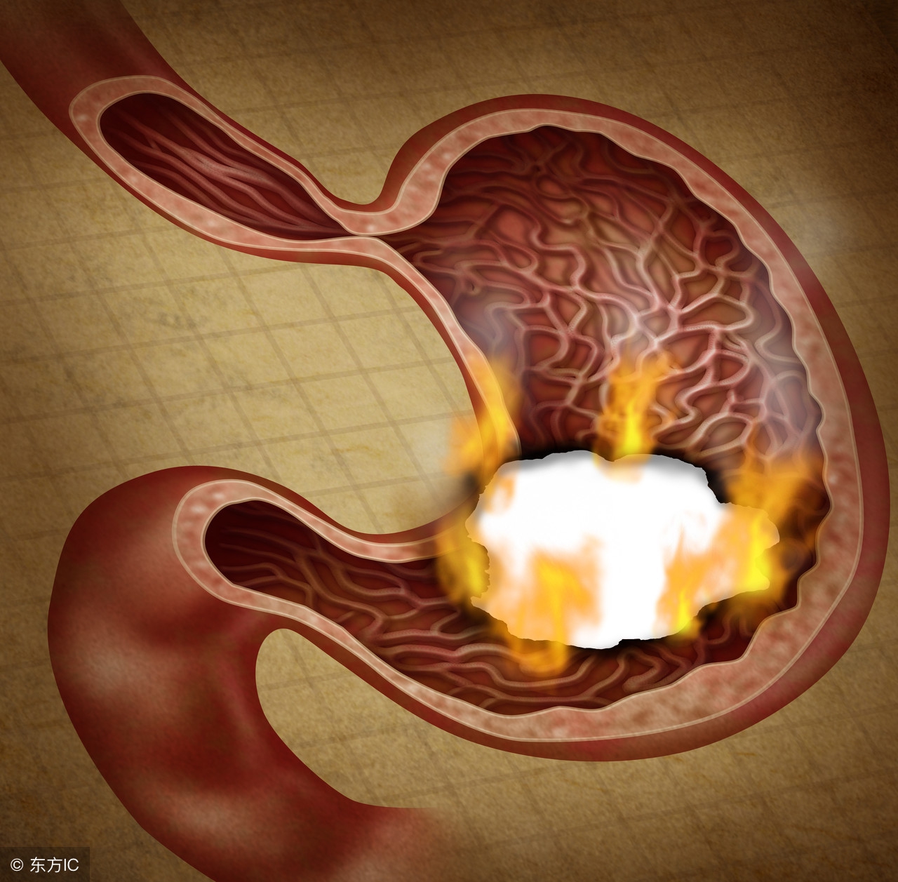 长期吃雷贝拉唑有什么副作用,雷贝拉唑建议长期服用吗