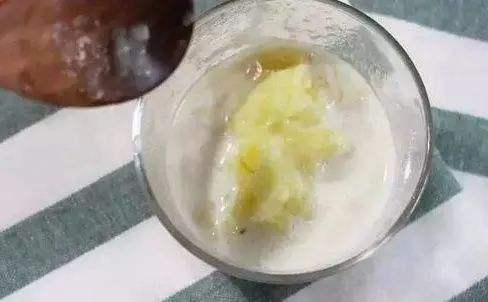 早上起来被自己眼睛吓到,眼周围的脂肪粒会自己消除