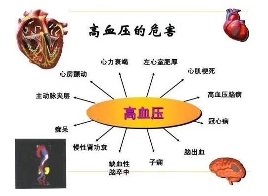 冠心病的血压怎么调理,冠心病高血压护理问题和措施