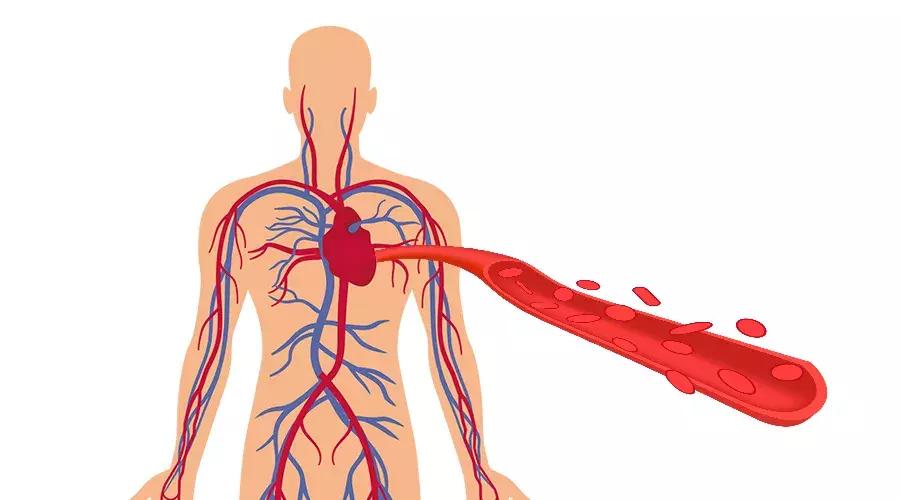 60岁的老人骨质疏松能补钙吗,动脉硬化骨质疏松吃什么