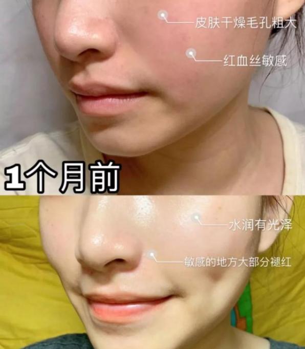 这面霜好用不踩雷,用过的都说好,让你做完美无瑕的瓷肌美人