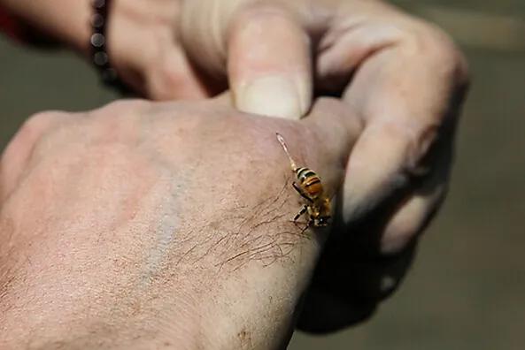 抓蜜蜂不小心被蜜蜂蛰,被蜜蜂蛰的第一时间