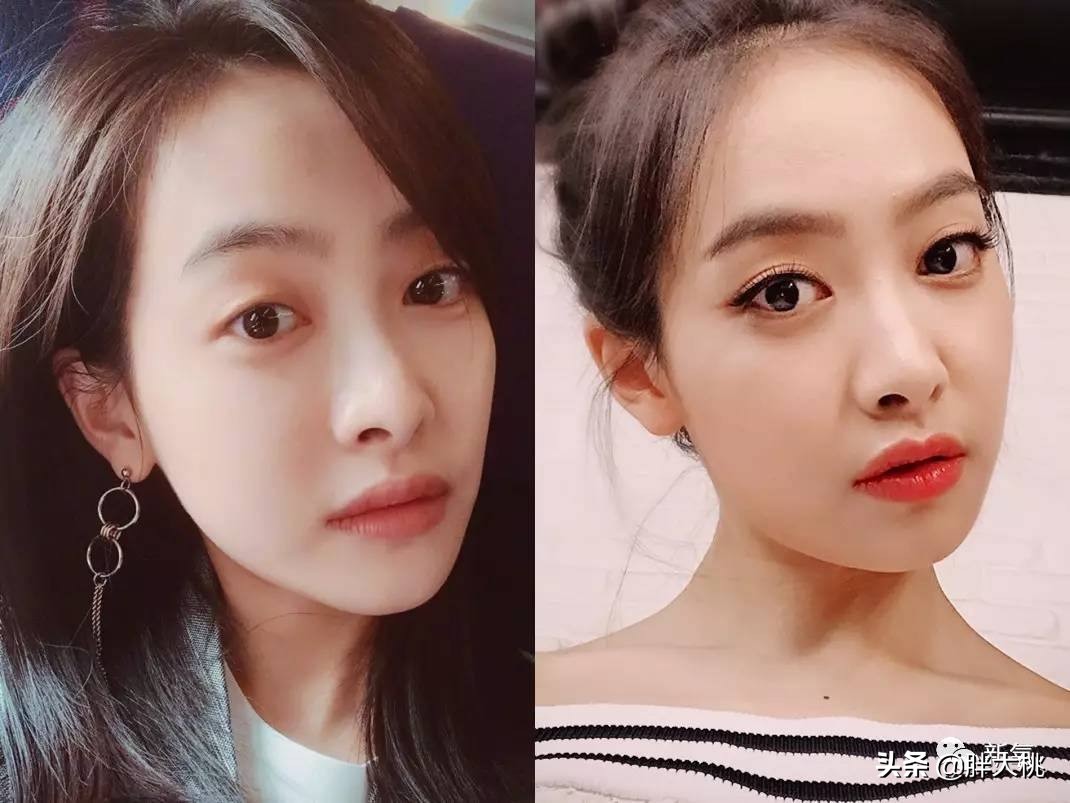 萧亚轩是不是打了玻尿酸一眼便知，明星没有玻尿酸会怎么样？