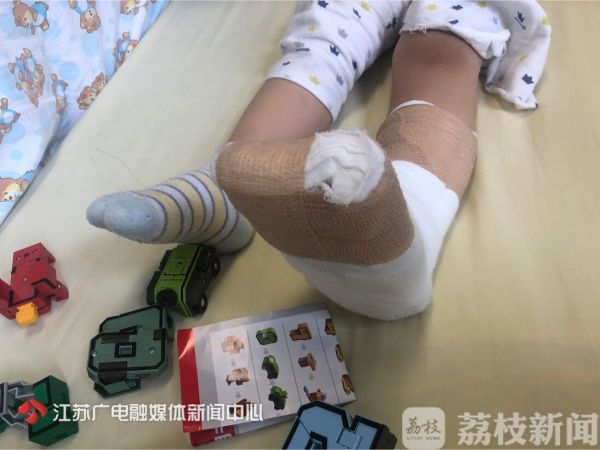 小孩在店里摔倒店里有责任吗,小孩在店内摔倒店家的责任