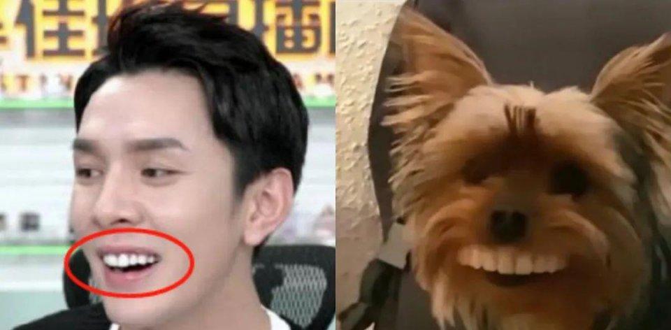 吴宣仪烤瓷牙怎么做,吴宣仪的整牙前