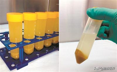 90%的肠道疾病治愈率！知道这颗药成分的我，哭了