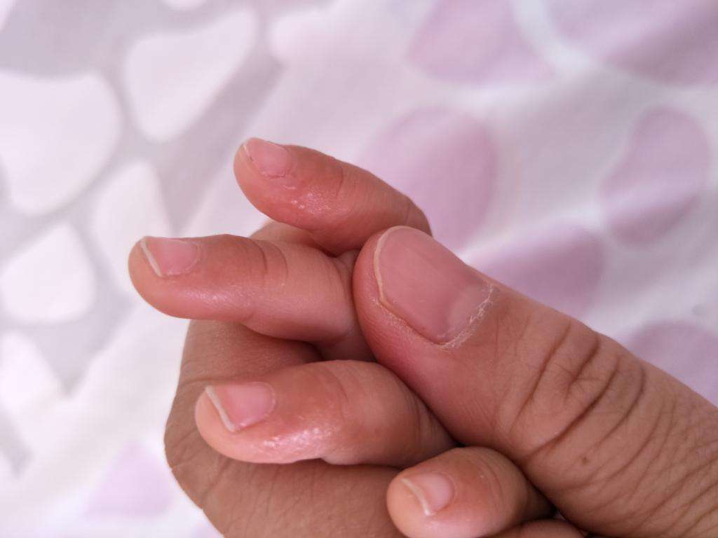 怎样防止小孩吮手指,如何改掉孩子睡觉吮手指