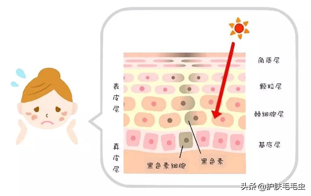 脸上长斑什么原因怎么消除,脸上长斑严重如何调理最简单有效