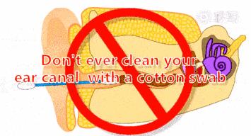 2岁宝宝掏出一长条耳屎,给宝宝掏出一堆耳屎