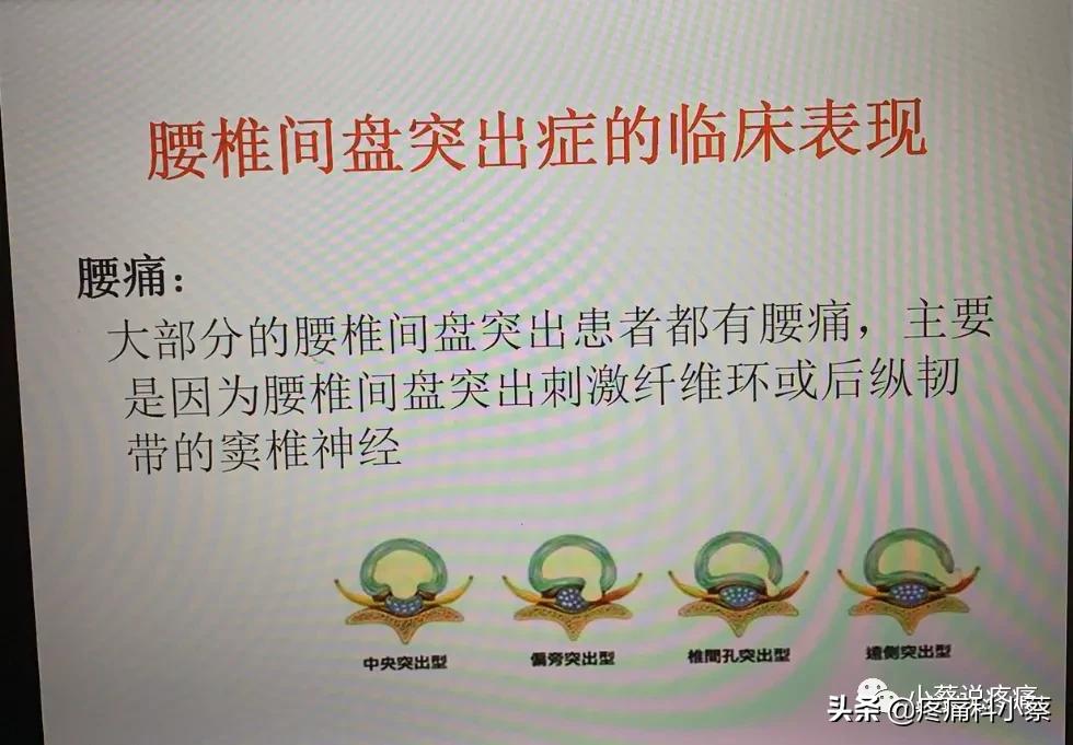 蔡主任讲座视频,蔡主任团队