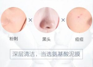 御泥坊去黑头怎么样,御泥坊去黑头收缩毛孔