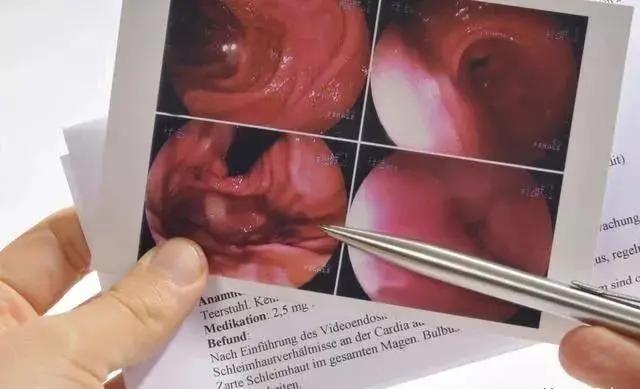 临床医生：3分钟看懂，胃镜活检病理报告！一定要收藏