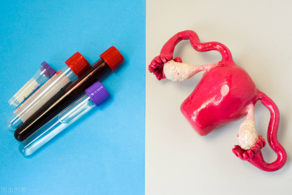 白带异常要如何做好预防的事情呢,白带检查能查出哪些问题