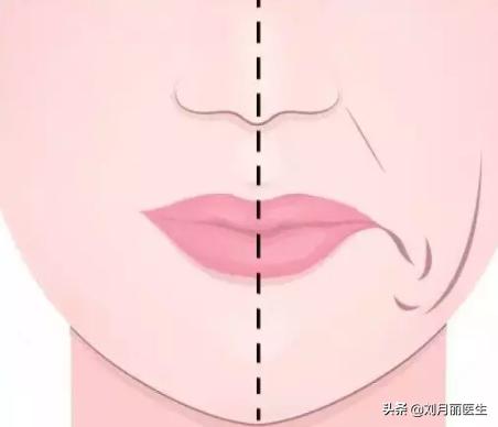 修复苹果肌改善法令纹,改善法令纹的面部运动