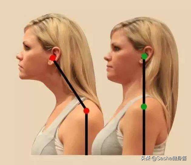 脖颈前伸腰背痛，都是探颈惹的祸，睡前做两个动作，改善探颈问题