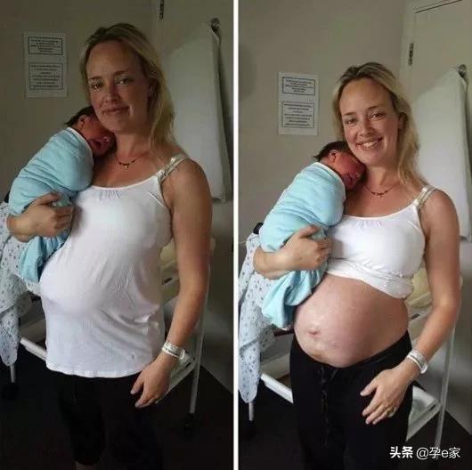 章子怡产后未p图曝光，二胎的她怎么变了？