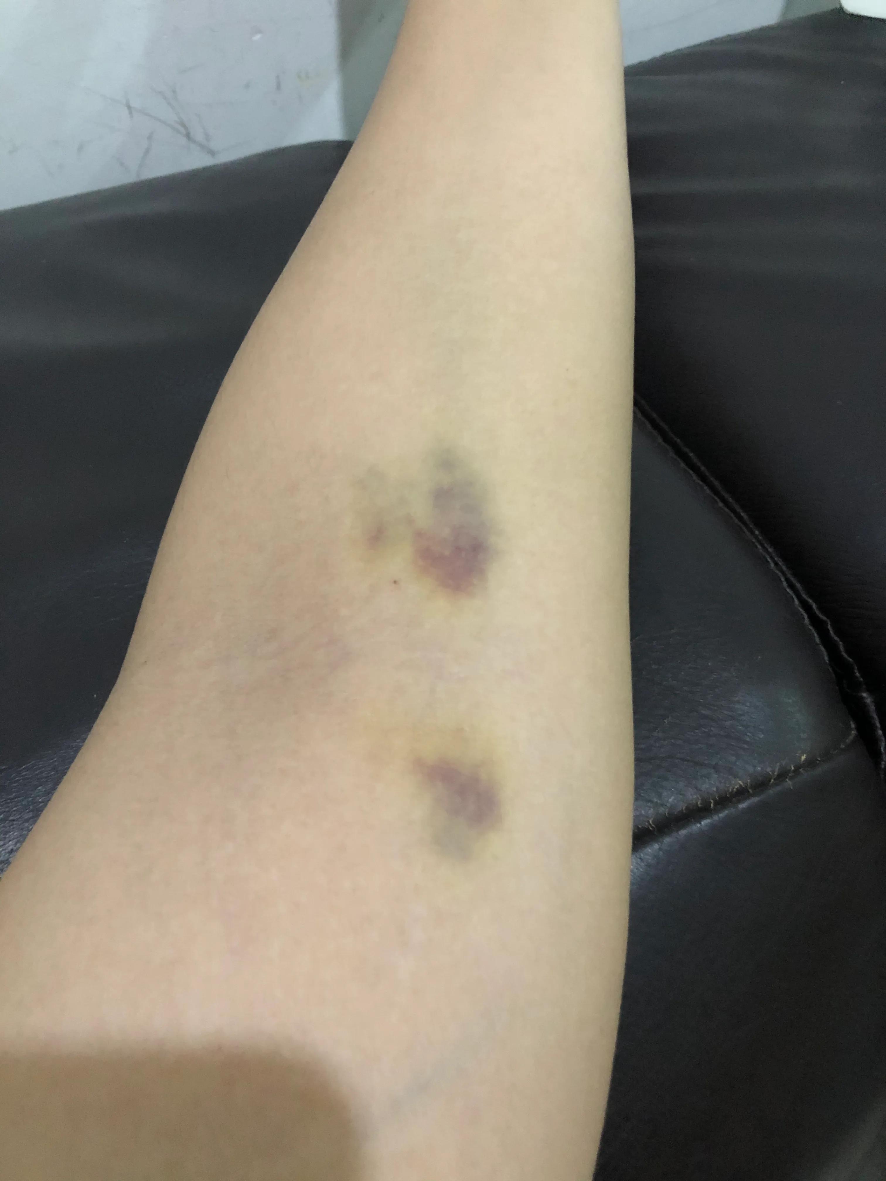 孕8周，保胎，每天与黄体酮一起度过