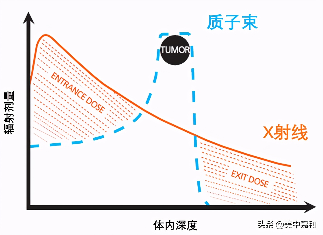 到底哪些人适于接受质子治疗？