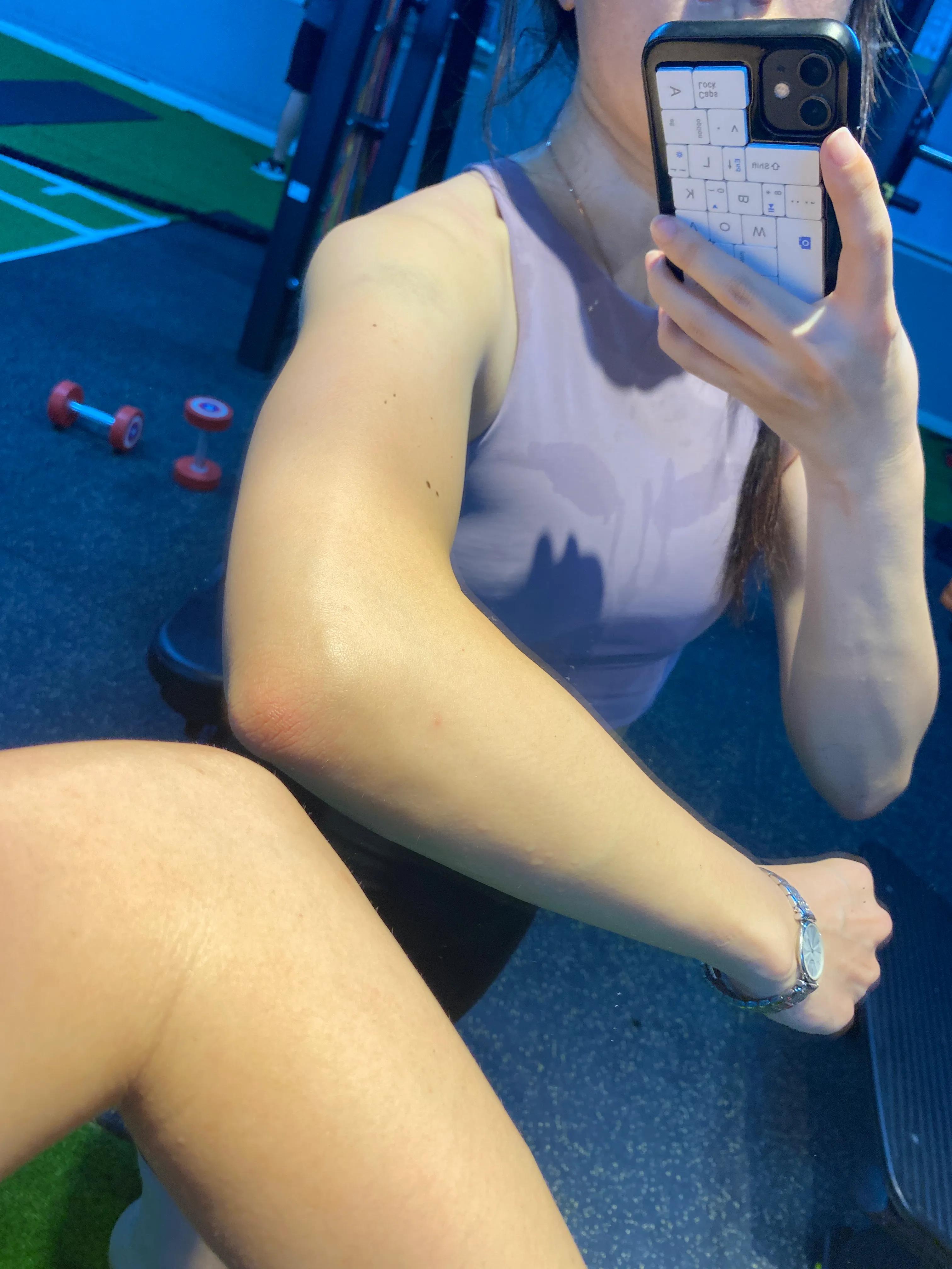 轻断食快速减内脏脂肪,轻断食减脂的正确方法