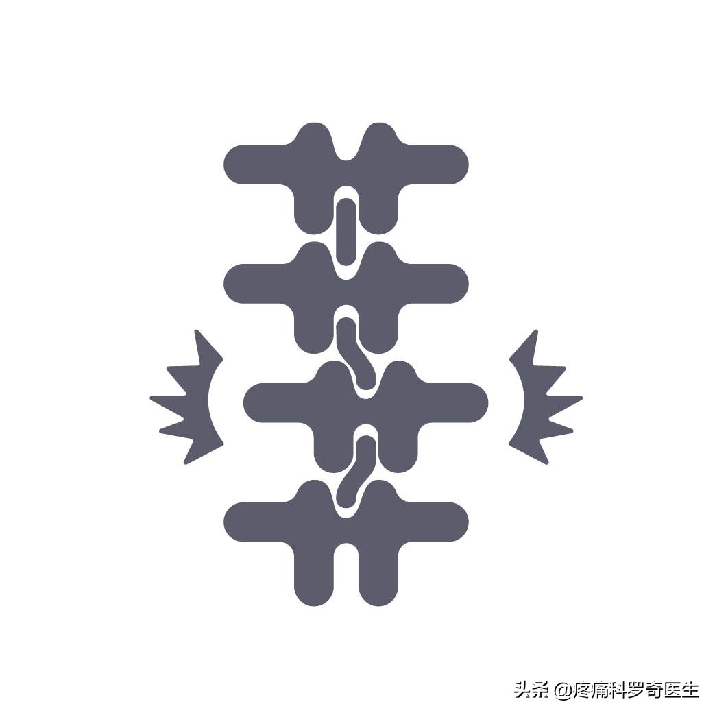 你的腰痛是怎么回事,你的腰痛是哪种