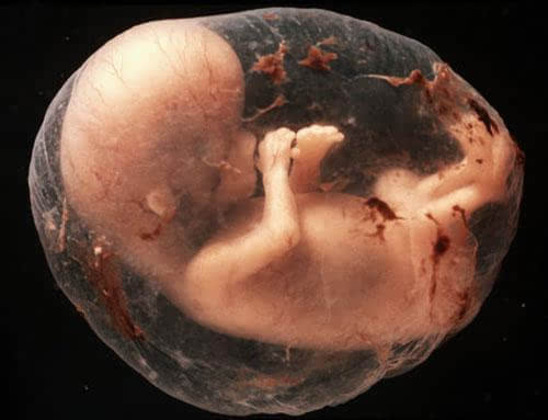 五十一岁女子被证明是男性,51岁女子被医学证明是男生