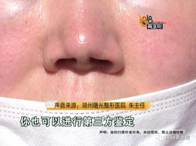 三年动刀三次,老公说她整得跟“猪”一样?