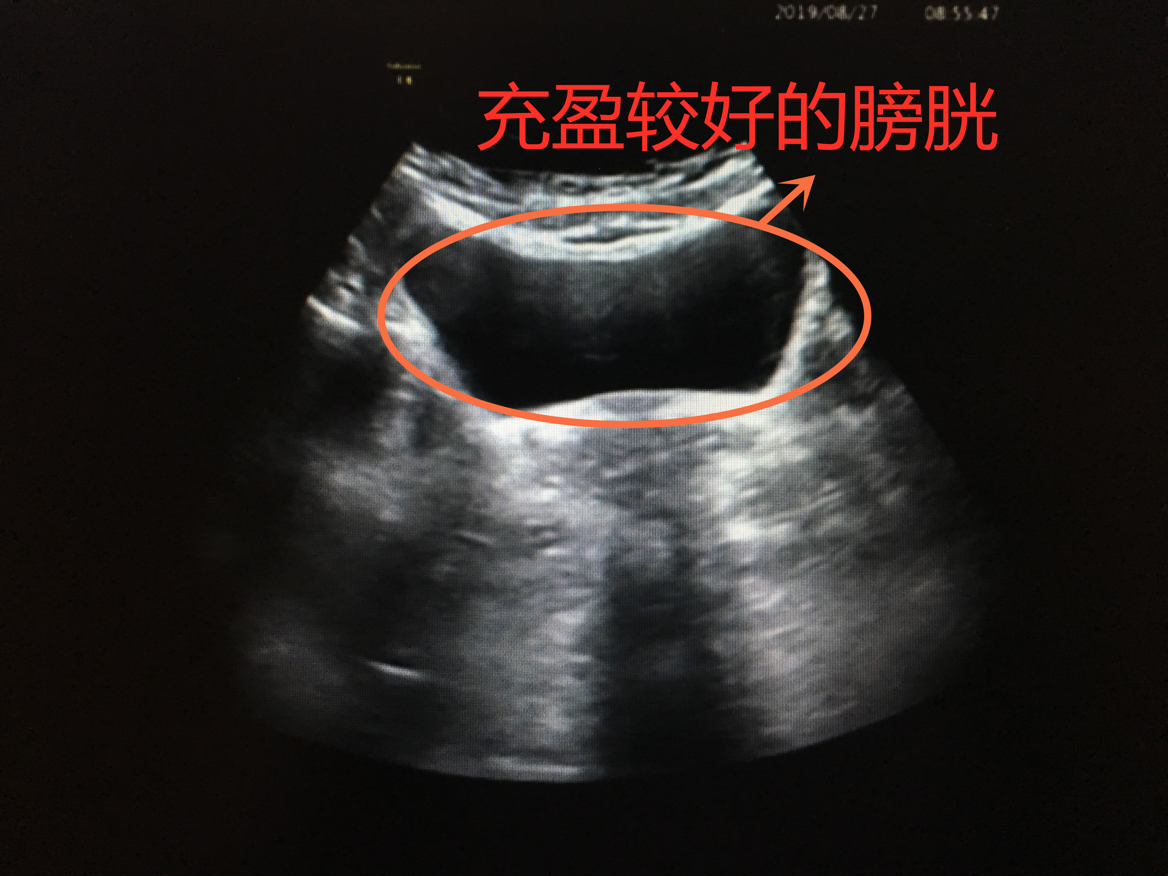 医生说的检查项目我们都必须做吗,医生告诉你应该做哪些检查