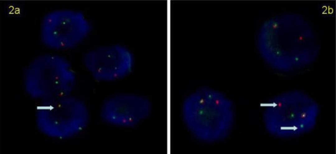 显微镜下的万花世界——走进病理学