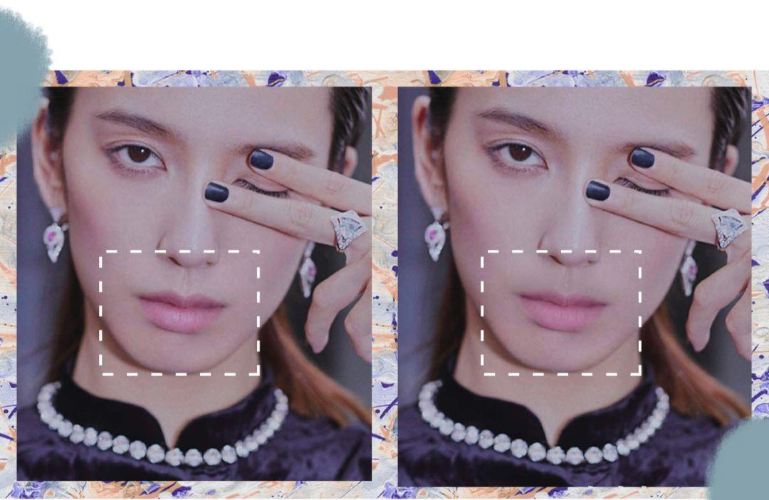 被丑哭了怎么办,被凸嘴拉低颜值怎么改善