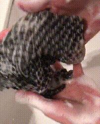 祛背部痘印的日常方法,用什么可以祛后背痘印