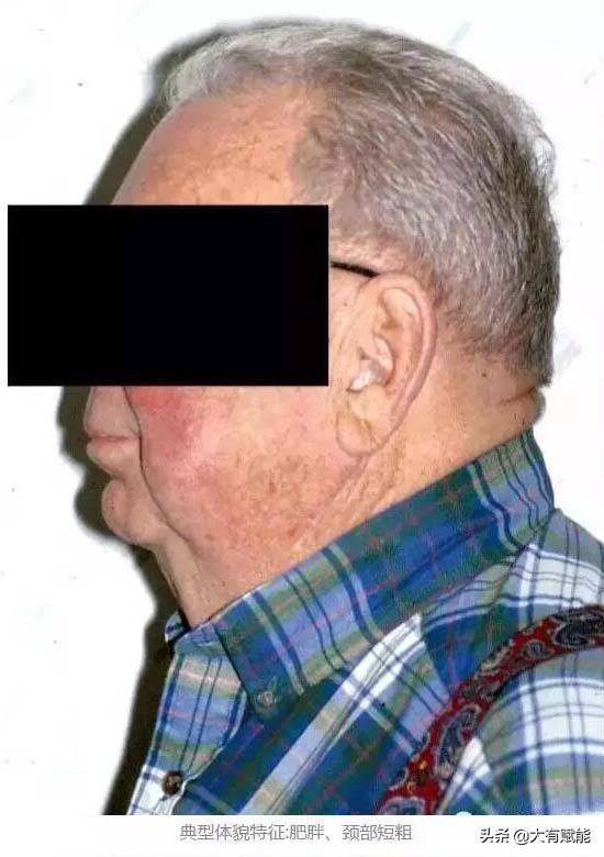 睡眠呼吸暂停监测全过程视频,深度解析呼吸暂停