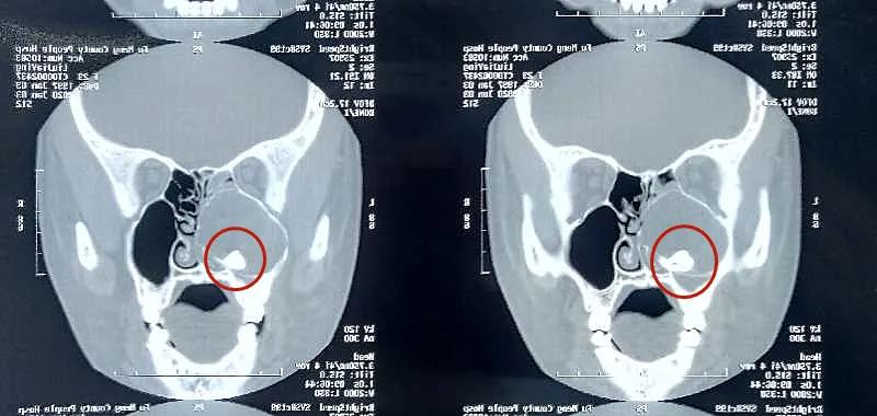 医院里的硬核技术,硬核医生硬核技术