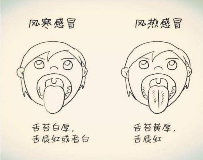 感冒咳嗽有黄痰是好转还是恶化,感冒后咳嗽有黄痰的最快治疗方法