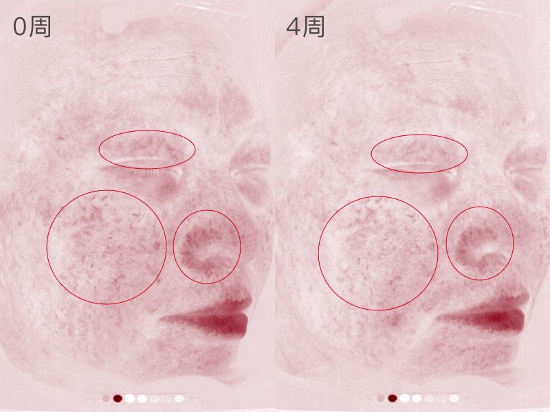 sk-II神仙水真的好用吗,SK-II神仙水好用吗