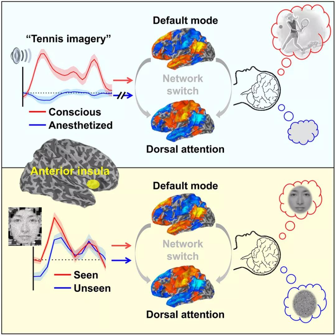 智力障碍成年人认知康复训练,智力障碍分级及预后