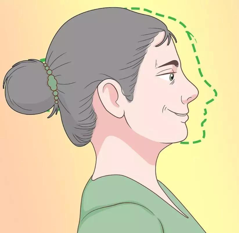 脊柱弯了怎么纠正视频,脊柱侧弯属于严重脊柱问题