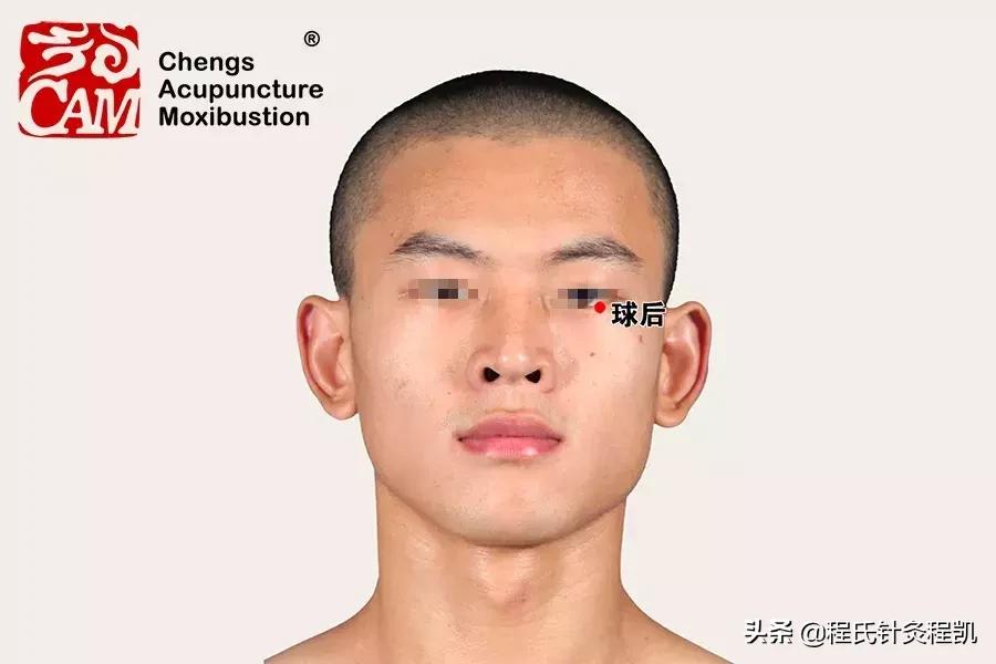 老年黄斑变性中医最新诊治思路,国医大师治黄斑变性医案