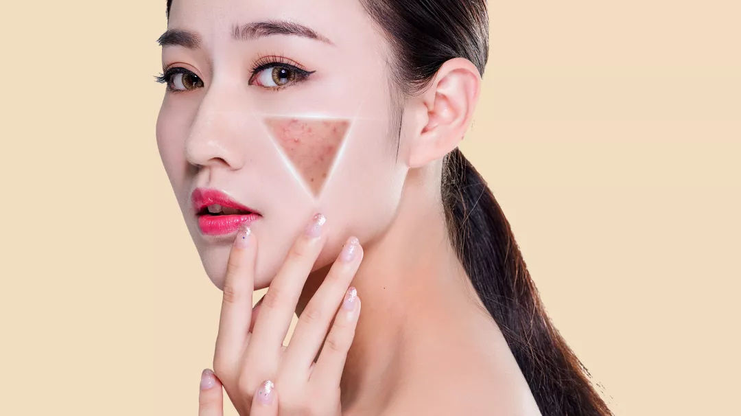 护肤品含铅汞停用后长斑,化妆品导致的铅汞斑能彻底治好吗