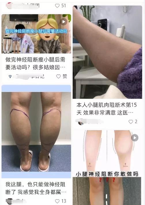 女子花50万整容被骗,女子花6万块整容被朋友毁容了