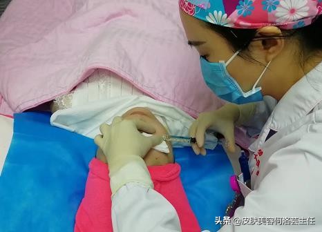 脸上有皱纹最快的去皱方法,脸上的皱纹用什么办法去皱效果好