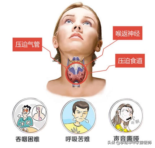 甲状腺疾病会导致失眠吗,长期失眠引起的甲亢怎么治疗