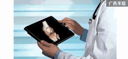 骨科大夫米琨为您详解:关节痛了怎么办?