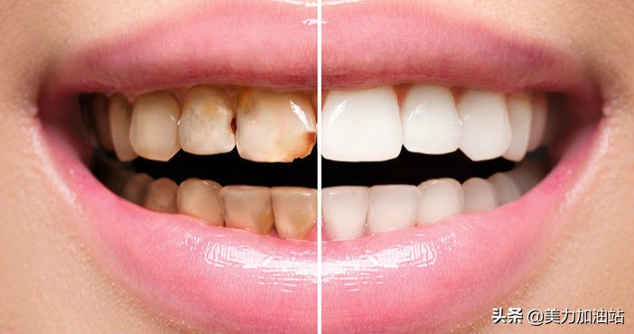 牙齿变白用什么口红好呢,牙齿美白用什么颜色的口红